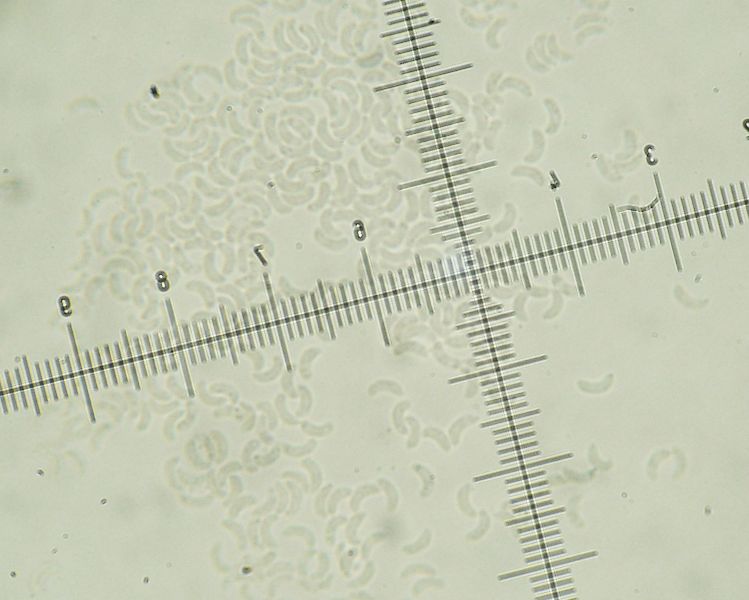 da determinare (Skeletocutis lilacina)